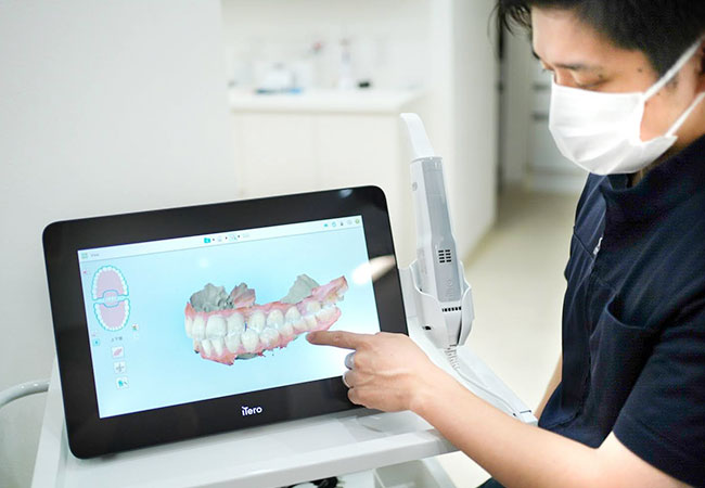 口腔内スキャナー